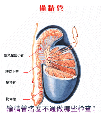 输精管堵塞不通